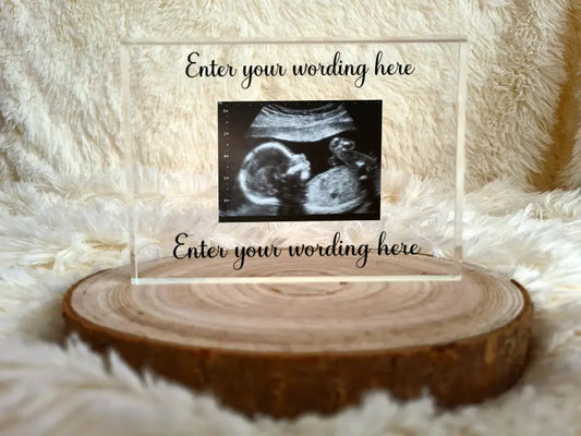 UV Printed Baby Scan Acrylic Block